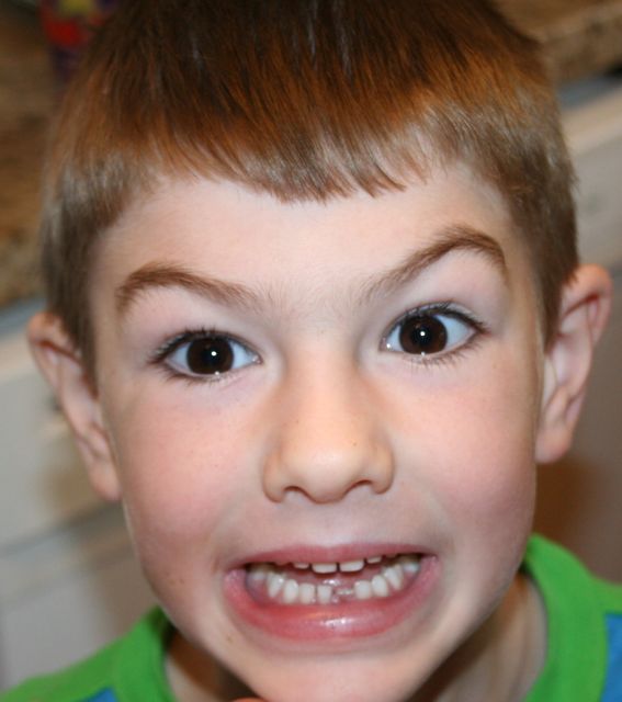 gap-toothed grin