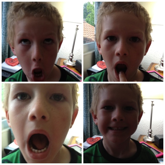 The Prince's Tooth Is Loose! The Prince's Tooth Is Loose!